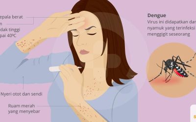 Lakukan Hal Ini Jika Ada Anggota Keluarga Terkena Gejala Demam Berdarah (DBD)